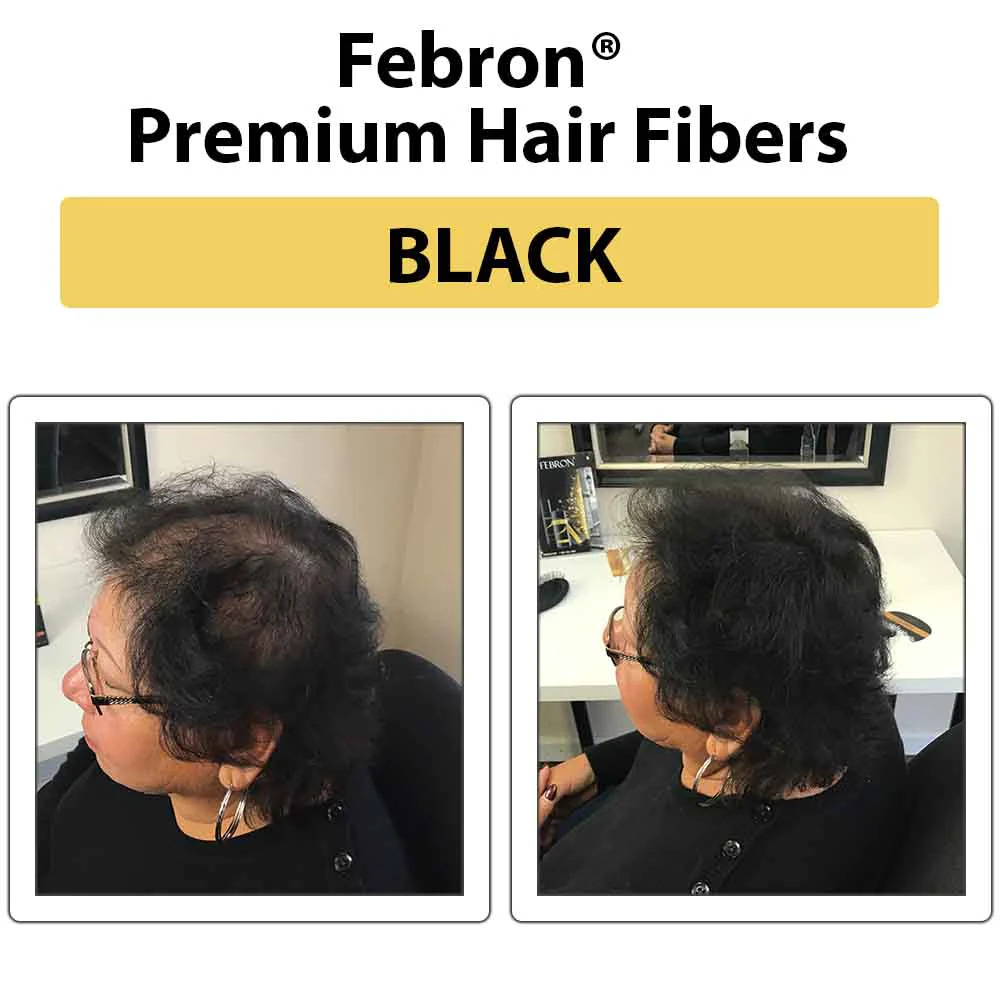 febron before and after