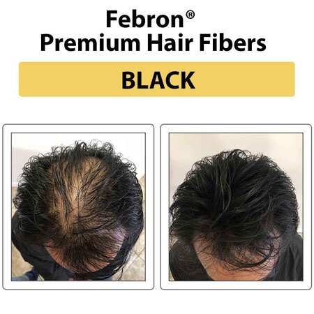 febron male before and after