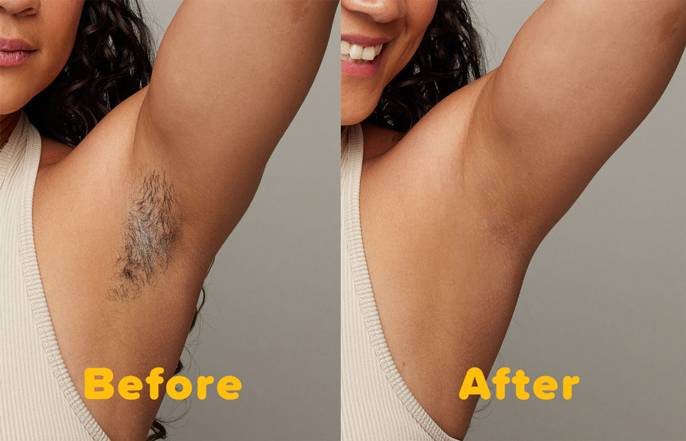 ulike before and after