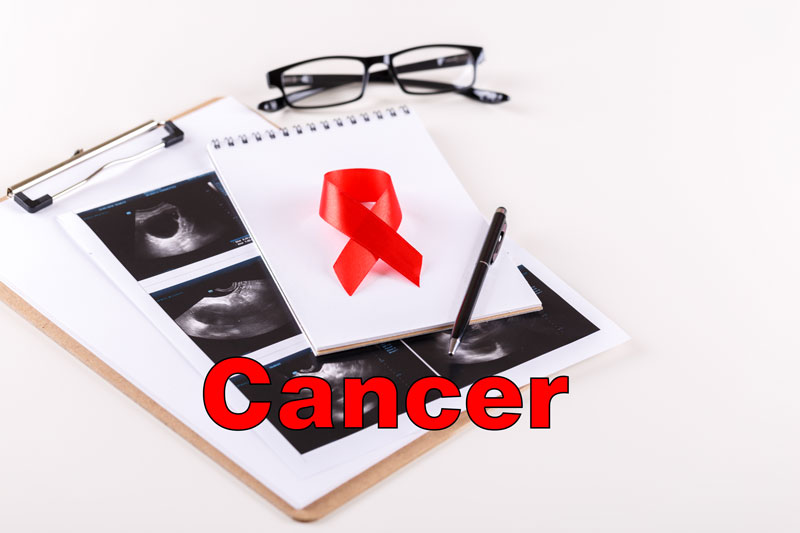 Cancer